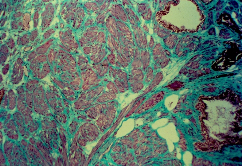 Histologie prostatique normale