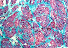 Musculature normale du col de la vessie (en rouge)